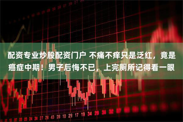 配资专业炒股配资门户 不痛不痒只是泛红，竟是癌症中期！男子后悔不已，上完厕所记得看一眼